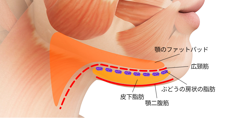 Long-Lasting Results and Definitive Improvement