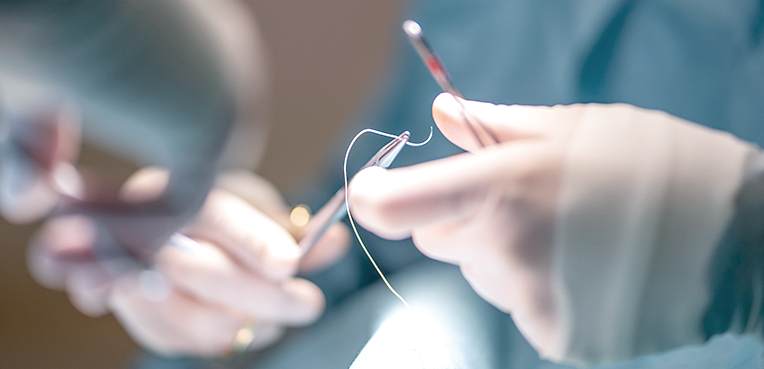 A最小切開で傷跡に対する 負担なく、安心ヒドゥンスカ