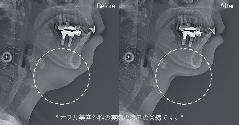 Precise Diagnosis for a Personalized Design